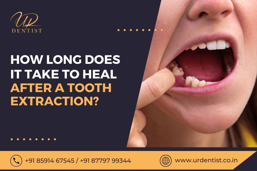 Tooth Extraction Healing Process In Pictures